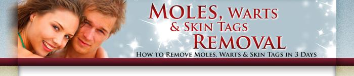 Moles, Warts & Skin Tags Gone In 3 Days