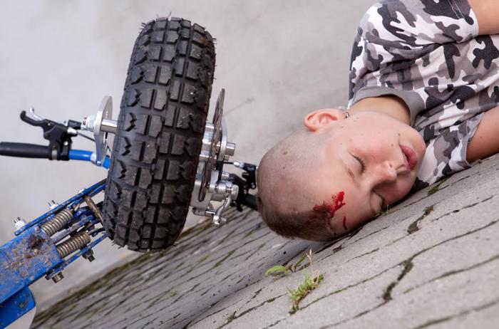Personal Injury Money - CALL 310-424-5176!