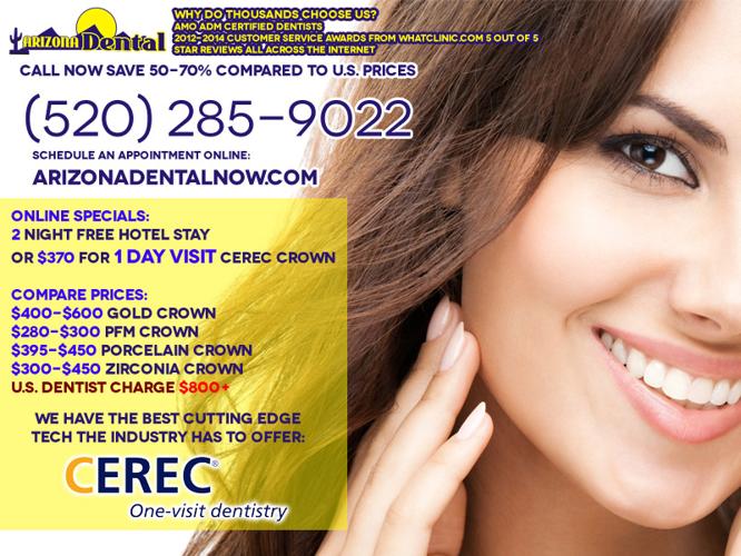 Save 50-70% on Dental Care | CEREC CROWN or CROWNS